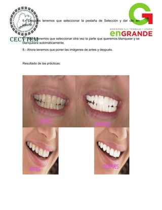 6.- Después tenemos que seleccionar la pestaña de Selección y dar clic en
invertir.



7.- Ahora tenemos que seleccionar otra vez la parte que queremos blanquear y se
blanqueara automáticamente.

8.- Ahora tenemos que poner las imágenes de antes y después.



Resultado de las prácticas:
 