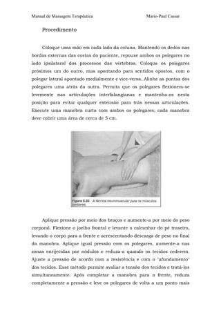 Manual de Massagem Terapêutica Mario-Paul Cassar 
Procedimento 
Coloque uma mão em cada lado da coluna. Mantendo os dedos nas 
bordas externas das costas do paciente, repouse ambos os polegares no 
lado ipsilateral dos processos das vértebras. Coloque os polegares 
próximos um do outro, mas apontando para sentidos opostos, com o 
polegar lateral apontado medialmente e vice-versa. Alinhe as pontas dos 
polegares uma atrás da outra. Permita que os polegares flexionem-se 
levemente nas articulações interfalangianas e mantenha-os nesta 
posição para evitar qualquer extensão para trás nessas articulações. 
Execute uma manobra curta com ambos os polegares; cada manobra 
deve cobrir uma área de cerca de 5 cm. 
Aplique pressão por meio dos braços e aumente-a por meio do peso 
corporal. Flexione o joelho frontal e levante o calcanhar do pé traseiro, 
levando o corpo para a frente e acrescentando descarga de peso no final 
da manobra. Aplique igual pressão com os polegares, aumente-a nas 
zonas enrijecidas por nódulos e reduza-a quando os tecidos cederem. 
Ajuste a pressão de acordo com a resistência e com o "afundamento" 
dos tecidos. Esse método permite avaliar a tensão dos tecidos e tratá-los 
simultaneamente. Após completar a manobra para a frente, reduza 
completamente a pressão e leve os polegares de volta a um ponto mais 
 
