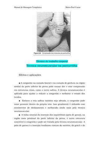 Manual de Massagem Terapêutica Mario-Paul Cassar 
Técnica de trabalho corporal 
Técnica neuromuscular na panturrilha 
Efeitos e aplicações 
■ A congestão na camada fascial e na camada de gordura na região 
medial da parte inferior da perna pode causar dor e criar compressão 
em estruturas vitais, como o nervo safeno. A técnica neuromuscular é 
aplicada para ajudar a reduzir a congestão e melhorar o estado dos 
tecidos. 
■ Embora a veia safena também seja afetada, a congestão pode 
estar presente dentro da própria veia. Isso geralmente é reduzido com 
movimentos de deslizamento e melhorado ainda mais pela técnica 
neuromuscular. 
■ A bolsa sinovial da inserção dos isquiotibiais (pata de ganso), na 
região mais proximal da parte inferior da perna, é outra estrutura 
suscetível à congestão e pode ser tratada pela técnica neuromuscular. A 
pata de ganso é a inserção tendinosa comum do sartório, do grácil e do 
 