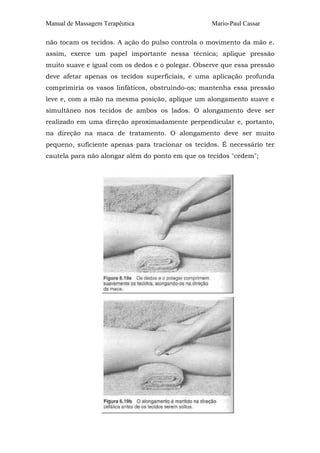 Manual de Massagem Terapêutica

Mario-Paul Cassar

não tocam os tecidos. A ação do pulso controla o movimento da mão e.
assim, exerce um papel importante nessa técnica; aplique pressão
muito suave e igual com os dedos e o polegar. Observe que essa pressão
deve afetar apenas os tecidos superficiais, e uma aplicação profunda
comprimiria os vasos linfáticos, obstruindo-os; mantenha essa pressão
leve e, com a mão na mesma posição, aplique um alongamento suave e
simultâneo nos tecidos de ambos os lados. O alongamento deve ser
realizado em uma direção aproximadamente perpendicular e, portanto,
na direção na maca de tratamento. O alongamento deve ser muito
pequeno, suficiente apenas para tracionar os tecidos. É necessário ter
cautela para não alongar além do ponto em que os tecidos "cedem";

 