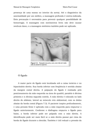 Manual de Massagem Terapêutica

Mario-Paul Cassar

presença de uma massa no interior da aorta). Até o diagnóstico da
anormalidade por um médico, a massagem profunda é contra-indicada.
Esta precaução é necessária para prevenir qualquer possibilidade de
hemorragia. A massagem com movimentos leves não deve causar
nenhum dano, e a massagem sistêmica também pode ser aplicada.

O fígado
A maior parte do fígado está localizada sob a caixa torácica e no
hipocôndrio direito. Sua borda inferior com freqüência é sentida abaixo
da margem costal direita. A palpação do fígado é realizada pelo
posicionamento da mão esquerda na área do quadril, paralelo à décima
primeira e à décima segunda costela. A mão direita é colocada no lado
direito do abdome, lateral ao músculo reto abdominal, com os dedos
abaixo da borda costal (Figura 7.3). O paciente inspira profundamente,
e uma pressão firme é aplicada com a mão esquerda para empurrar o
fígado anteriormente. Conforme o diafragma empurra o fígado para
baixo, a borda inferior pode ser palpada com a mão direita. A
identificação pode ser mais fácil se a mão direita passar por cima da
borda do fígado durante a descida. Também é útil reduzir a pressão da

 