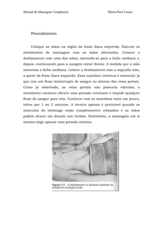 Manual de Massagem Terapêutica

Mario-Paul Cassar

Procedimento
Coloque as mãos na região da fossa ilíaca esquerda. Execute os
movimentos de massagem com as mãos alternadas. Comece o
deslizamento com uma das mãos, movendo-se para a linha mediana e,
depois, continuando para a margem costa! direita. A medida que a mão
atravessa a linha mediana, comece o deslizamento com a segunda mão,
a partir da fossa ilíaca esquerda. Essa manobra contínua é essencial, já
que cria um fluxo ininterrupto de sangue no interior das veias portais.
Como já observado, as veias portais não possuem válvulas; o
movimento contínuo oferece uma pressão constante e impede qualquer
fluxo do sangue para trás. Continue com as manobras mais um pouco,
talvez por 1 ou 2 minutos. A técnica apenas é praticável quando os
músculos do estômago estão completamente relaxados e as mãos
podem descer em direção aos tecidos. Entretanto, a massagem em si
mesma exige apenas uma pressão mínima.

 