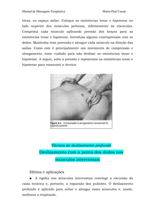 Manual de Massagem Terapêutica

Mario-Paul Cassar

tórax, no espaço axilar. Coloque as eminências tenar e hipotenar no
lado superior dos músculos peitorais, inferiormente às clavículas.
Comprima cada músculo aplicando pressão dos braços para as
eminências tenar e hipotenar. Introduza alguma contrapressão com os
dedos. Mantenha essa preensão e alongue cada músculo na direção das
axilas. Como este é principalmente um movimento de compressão e
alongamento, tome cuidado para não deslizar as eminências tenar e
hipotenar. A seguir, solte a pressão e reposicione as eminências tenar e
hipotenar para reassumir a técnica.

Técnica de deslizamento profundo

Deslizamento com a ponta dos dedos nos
músculos intercostais
Efeitos e aplicações
■

A rigidez nos músculos intercostais restringe a excursão da

caixa torácica e, portanto, a expansão dos pulmões. O deslizamento
profundo é aplicado para soltar e alongar esses músculos e, assim,
melhorar a respiração.

 