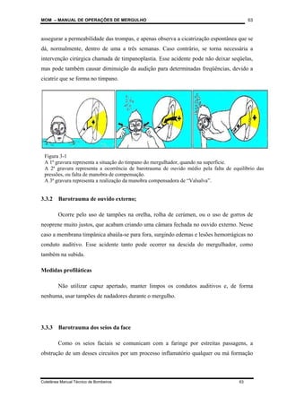 MOM – MANUAL DE OPERAÇÕES DE MERGULHO
Coletânea Manual Técnico de Bombeiros 63
63
assegurar a permeabilidade das trompas, e apenas observa a cicatrização espontânea que se
dá, normalmente, dentro de uma a três semanas. Caso contrário, se torna necessária a
intervenção cirúrgica chamada de timpanoplastia. Esse acidente pode não deixar seqüelas,
mas pode também causar diminuição da audição para determinadas freqüências, devido a
cicatriz que se forma no tímpano.
3.3.2 Barotrauma de ouvido externo;
Ocorre pelo uso de tampões na orelha, rolha de cerúmen, ou o uso de gorros de
neoprene muito justos, que acabam criando uma câmara fechada no ouvido externo. Nesse
caso a membrana timpânica abaúla-se para fora, surgindo edemas e lesões hemorrágicas no
conduto auditivo. Esse acidente tanto pode ocorrer na descida do mergulhador, como
também na subida.
Medidas profiláticas
Não utilizar capuz apertado, manter limpos os condutos auditivos e, de forma
nenhuma, usar tampões de nadadores durante o mergulho.
3.3.3 Barotrauma dos seios da face
Como os seios faciais se comunicam com a faringe por estreitas passagens, a
obstrução de um desses circuitos por um processo inflamatório qualquer ou má formação
Figura 3-1
A 1ª gravura representa a situação do tímpano do mergulhador, quando na superfície.
A 2ª gravura representa a ocorrência de barotrauma de ouvido médio pela falta de equilíbrio das
pressões, ou falta de manobra de compensação.
A 3ª gravura representa a realização da manobra compensadora de “Valsalva”.
 