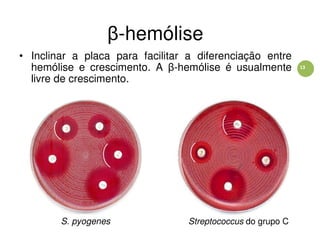 13
β-hemólise
• Inclinar a placa para facilitar a diferenciação entre
hemólise e crescimento. A β-hemólise é usualmente
livre de crescimento.
S. pyogenes Streptococcus do grupo C
 