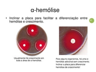 14
α-hemólise
• Inclinar a placa para facilitar a diferenciação entre
hemólise e crescimento.
Usualmente há crescimento em
toda a área de α-hemólise.
Para alguns organismos, há uma α-
hemólise adicional sem crescimento.
Inclinar a placa para diferenciar
hemólise de crescimento!
 