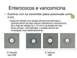 20
Enterococos e vancomicina
• Examinar com luz transmitida (placa posicionada contra
a luz).
– Halos de inibição com bordas difusas/mal definidas e
colônias dentro do halo indicam resistência à vancomicina.
Se o halo de inibição for ≥ 12 mm e as bordas do halo
forem difusas / mal definidas, o isolado deverá ser
investigado mais detalhadamente.
E. faecalis E. faecium
não-VRE VRE
 