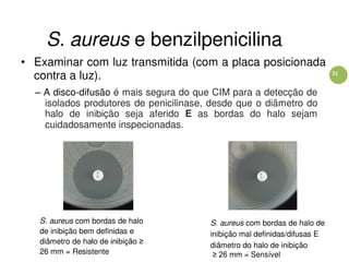 21
S. aureus e benzilpenicilina
• Examinar com luz transmitida (com a placa posicionada
contra a luz).
– A disco-difusão é mais segura do que CIM para a detecção de
isolados produtores de penicilinase, desde que o diâmetro do
halo de inibição seja aferido E as bordas do halo sejam
cuidadosamente inspecionadas.
S. aureus com bordas de halo
de inibição bem definidas e
diâmetro de halo de inibição ≥
26 mm = Resistente
S. aureus com bordas de halo de
inibição mal definidas/difusas E
diâmetro do halo de inibição
≥ 26 mm = Sensível
 