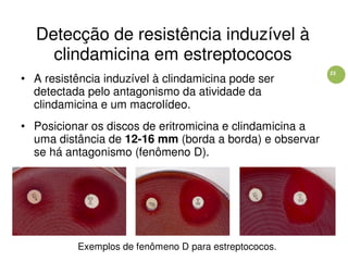 23
Detecção de resistência induzível à
clindamicina em estreptococos
• A resistência induzível à clindamicina pode ser
detectada pelo antagonismo da atividade da
clindamicina e um macrolídeo.
• Posicionar os discos de eritromicina e clindamicina a
uma distância de 12-16 mm (borda a borda) e observar
se há antagonismo (fenômeno D).
Exemplos de fenômeno D para estreptococos.
 