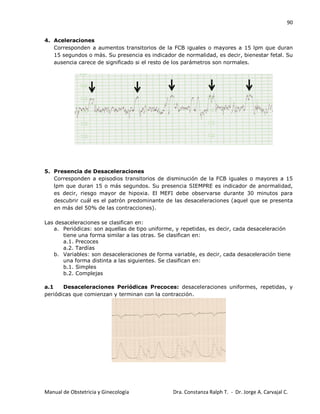 90
Manual de Obstetricia y Ginecología Dra. Constanza Ralph T. - Dr. Jorge A. Carvajal C.
4. Aceleraciones
Corresponden a aumentos transitorios de la FCB iguales o mayores a 15 lpm que duran
15 segundos o más. Su presencia es indicador de normalidad, es decir, bienestar fetal. Su
ausencia carece de significado si el resto de los parámetros son normales.
5. Presencia de Desaceleraciones
Corresponden a episodios transitorios de disminución de la FCB iguales o mayores a 15
lpm que duran 15 o más segundos. Su presencia SIEMPRE es indicador de anormalidad,
es decir, riesgo mayor de hipoxia. El MEFI debe observarse durante 30 minutos para
descubrir cuál es el patrón predominante de las desaceleraciones (aquel que se presenta
en más del 50% de las contracciones).
Las desaceleraciones se clasifican en:
a. Periódicas: son aquellas de tipo uniforme, y repetidas, es decir, cada desaceleración
tiene una forma similar a las otras. Se clasifican en:
a.1. Precoces
a.2. Tardías
b. Variables: son desaceleraciones de forma variable, es decir, cada desaceleración tiene
una forma distinta a las siguientes. Se clasifican en:
b.1. Simples
b.2. Complejas
a.1 Desaceleraciones Periódicas Precoces: desaceleraciones uniformes, repetidas, y
periódicas que comienzan y terminan con la contracción.
 