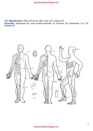 4
3.2. Hipertensión: TR20, V10-23-32, VB31, V54, VC17, E25-36, R7.
Auricular: Suprarrenal 36, canal auditivo-subcórtex 18, Shenmen 58, hipertensión 79 ó 29,
simpático 57.
http://bookmedico.blogspot.com
http://bookmedico.blogspot.com
 