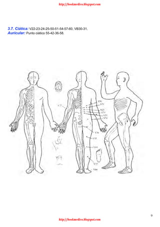 9
3.7. Ciática: V22-23-24-25-50-51-54-57-60, VB30-31.
Auricular: Punto ciático 55-42-36-58.
http://bookmedico.blogspot.com
http://bookmedico.blogspot.com
 