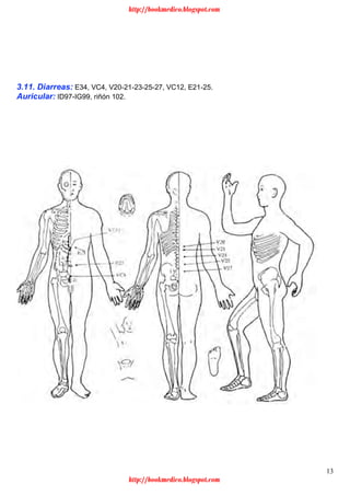 13
3.11. Diarreas: E34, VC4, V20-21-23-25-27, VC12, E21-25.
Auricular: ID97-IG99, riñón 102.
http://bookmedico.blogspot.com
http://bookmedico.blogspot.com
 