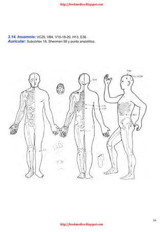 16
3.14. Insomnio: VC20, VB4, V10-18-20, H13, E36.
Auricular: Subcórtex 18, Shenmen 58 y punto ansiolítico.
http://bookmedico.blogspot.com
http://bookmedico.blogspot.com
 