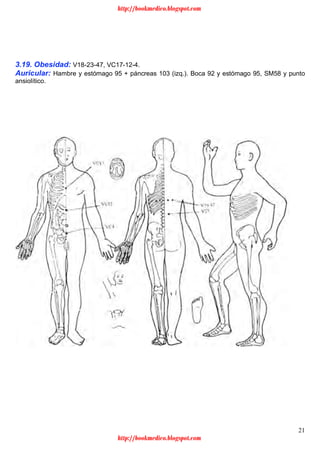 21
3.19. Obesidad: V18-23-47, VC17-12-4.
Auricular: Hambre y estómago 95 + páncreas 103 (izq.). Boca 92 y estómago 95, SM58 y punto
ansiolítico.
http://bookmedico.blogspot.com
http://bookmedico.blogspot.com
 