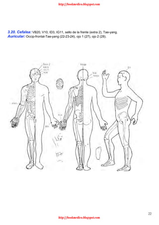 22
3.20. Cefalea: VB20, V10, ID3, IG11, sello de la frente (extra 2), Tae-yang.
Auricular: Occip-frontal-Tae-yang (22-23-24), ojo 1 (27), ojo 2 (28).
http://bookmedico.blogspot.com
http://bookmedico.blogspot.com
 