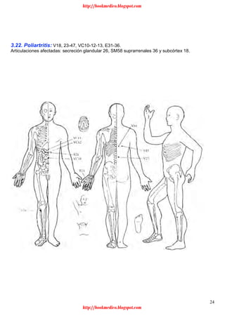24
3.22. Poliartritis: V18, 23-47, VC10-12-13, E31-36.
Articulaciones afectadas: secreción glandular 26, SM58 suprarrenales 36 y subcórtex 18.
http://bookmedico.blogspot.com
http://bookmedico.blogspot.com
 