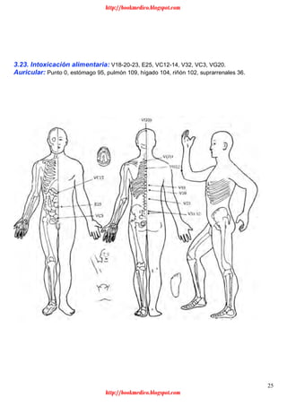 25
3.23. Intoxicación alimentaria: V18-20-23, E25, VC12-14, V32, VC3, VG20.
Auricular: Punto 0, estómago 95, pulmón 109, hígado 104, riñón 102, suprarrenales 36.
http://bookmedico.blogspot.com
http://bookmedico.blogspot.com
 