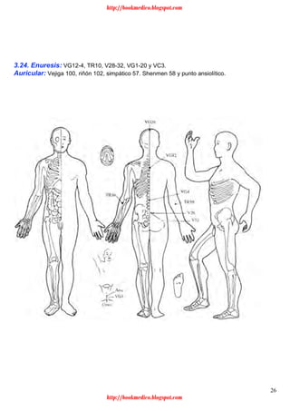 26
3.24. Enuresis: VG12-4, TR10, V28-32, VG1-20 y VC3.
Auricular: Vejiga 100, riñón 102, simpático 57. Shenmen 58 y punto ansiolítico.
http://bookmedico.blogspot.com
http://bookmedico.blogspot.com
 