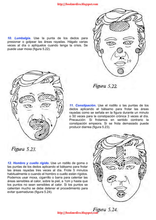 15
10. Lumbalgia. Use la punta de los dedos para
presionar o golpear las áreas rayadas. Hágalo varias
veces al día o aplíquelos cuando tenga la crisis. Se
puede usar moxa (figura 5.22).
11. Constipación. Use el rodillo o las puntas de los
dedos aplicando el bálsamo para frotar las áreas
rayadas como se señala en la figura durante un minuto
o 50 veces para la constipación crónica 3 veces al día.
Precaución: Si frotamos en sentido contrario la
constipación empeora. Si se frota demasiado puede
producir diarrea (figura 5.23).
12. Hombro y cuello rígido. Use un rodillo de goma o
las puntas de los dedos aplicando el bálsamo para frotar
las áreas rayadas tres veces al día. Frote 5 minutos
habitualmente o cuando el hombro o cuello están rígidos.
Podemos usar moxa, cigarrillo o barra para calentar las
áreas sensibles al calor, sobre la piel, a 1cm y hasta que
los puntos no sean sensibles al calor. Si los puntos se
calientan mucho se debe detener el procedimiento para
evitar quemaduras (figura 5.24).
http://bookmedico.blogspot.com
http://bookmedico.blogspot.com
 