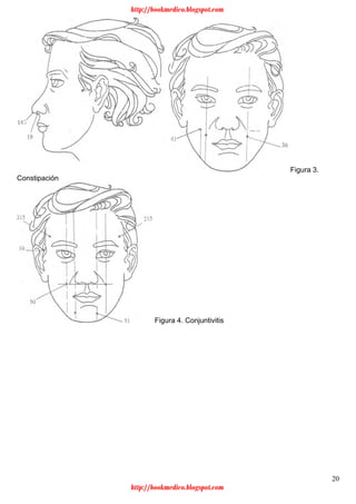 20
Figura 3.
Constipación
Figura 4. Conjuntivitis
http://bookmedico.blogspot.com
http://bookmedico.blogspot.com
 