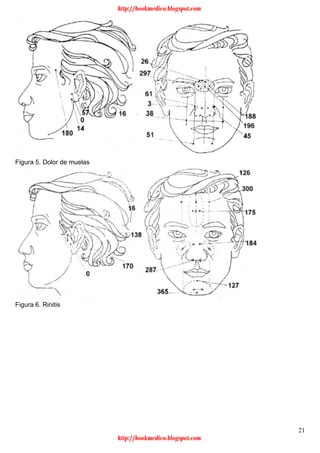 21
Figura 5. Dolor de muelas
Figura 6. Rinitis
http://bookmedico.blogspot.com
http://bookmedico.blogspot.com
 
