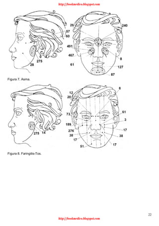 22
Figura 7. Asma.
Figura 8. Faringitis-Tos.
http://bookmedico.blogspot.com
http://bookmedico.blogspot.com
 