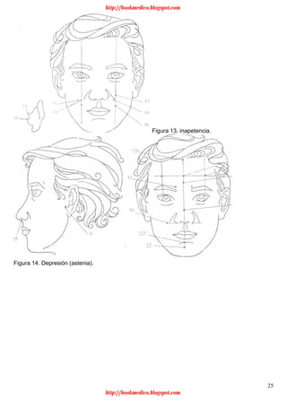 25
Figura 13. inapetencia.
Figura 14. Depresión (astenia).
http://bookmedico.blogspot.com
http://bookmedico.blogspot.com
 