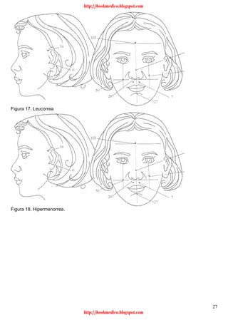 27
Figura 17. Leucorrea
Figura 18. Hipermenorrea.
http://bookmedico.blogspot.com
http://bookmedico.blogspot.com
 