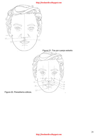 29
Figura 21. Tos por cuerpo extraño
Figura 22. Parasitismo-cólicos. .
http://bookmedico.blogspot.com
http://bookmedico.blogspot.com
 