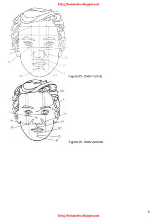 31
Figura 25. Catarro (frío).
Figura 26. Dolor cervical.
http://bookmedico.blogspot.com
http://bookmedico.blogspot.com
 