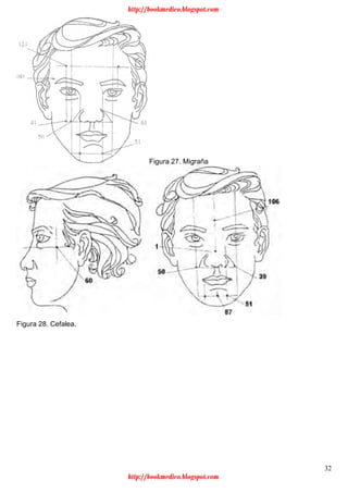 32
Figura 27. Migraña
Figura 28. Cefalea.
http://bookmedico.blogspot.com
http://bookmedico.blogspot.com
 