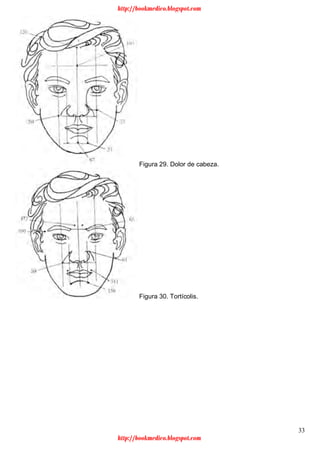 33
Figura 29. Dolor de cabeza.
Figura 30. Tortícolis.
http://bookmedico.blogspot.com
http://bookmedico.blogspot.com
 
