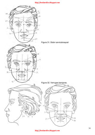 34
Figura 31. Dolor cervicobraquial
Figura 32. Verrugas benignas.
http://bookmedico.blogspot.com
http://bookmedico.blogspot.com
 