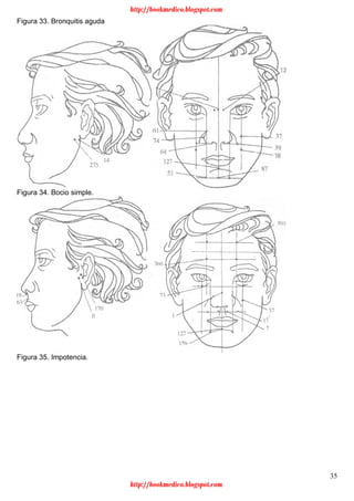 35
Figura 33. Bronquitis aguda
Figura 34. Bocio simple.
Figura 35. Impotencia.
http://bookmedico.blogspot.com
http://bookmedico.blogspot.com
 
