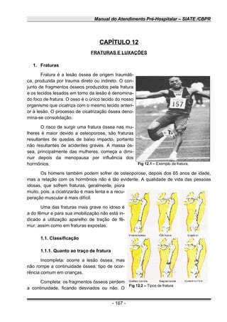 Manual do Atendimento Pré-Hospitalar – SIATE /CBPR
CAPÍTULO 12
FRATURAS E LUXAÇÕES
1. Fraturas
Fratura é a lesão óssea de origem traumáti-
ca, produzida por trauma direto ou indireto. O con-
junto de fragmentos ósseos produzidos pela fratura
e os tecidos lesados em torno da lesão é denomina-
do foco de fratura. O osso é o único tecido do nosso
organismo que cicatriza com o mesmo tecido anteri-
or à lesão. O processo de cicatrização óssea deno-
mina-se consolidação.
O risco de surgir uma fratura óssea nas mu-
lheres é maior devido a osteoporose, são fraturas
resultantes de quedas de baixo impacto, portanto
não resultantes de acidentes graves. A massa ós-
sea, principalmente das mulheres, começa a dimi-
nuir depois da menopausa por influência dos
hormônios.
Os homens também podem sofrer de osteoporose, depois dos 65 anos de idade,
mas a relação com os hormônios não é tão evidente. A qualidade de vida das pessoas
idosas, que sofrem fraturas, geralmente, piora
muito, pois, a cicatrizarão é mais lenta e a recu-
peração muscular é mais difícil.
Uma das fraturas mais grave no idoso é
a do fêmur e para sua imobilização não está in-
dicado a utilização aparelho de tração de fê-
mur, assim como em fraturas expostas.
1.1. Classificação
1.1.1. Quanto ao traço de fratura
Incompleta: ocorre a lesão óssea, mas
não rompe a continuidade óssea; tipo de ocor-
rência comum em crianças.
Completa: os fragmentos ósseos perdem
a continuidade, ficando desviados ou não. O
- 167 -
Fig 12.1 – Exemplo de fratura.
Fig 12.2 – Tipos de fratura
 