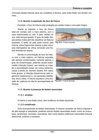 Fraturas e Luxações
manuseio destas fraturas deve ser cuidadoso e técnico, para evitar lesão nos tecidos vizi-
nhos
1.1.2. Quanto à exposição do foco de fratura
Fechada: o foco de fratura está protegido por partes moles e com pele íntegra.
Aberta ou exposta: o foco de fratura
está em contato com o meio externo, com o
osso exteriorizado ou não. A pele, nestes ca-
sos, está sempre lesada. O grau de lesão des-
sas partes moles permite classificar as fraturas
expostas. A lesão da pele pode ocorrer pelo
trauma, pelos fragmentos ósseos e pelo manu-
seio intempestivo da vítima, tornando uma fra-
tura fechada em aberta.
Devido à comunicação do foco de fratu-
ra com o meio externo, as fraturas expostas
são sempre contaminadas, variando apenas o
grau de contaminação, podendo causar osteo-
mielite (infecção óssea), que retarda ou impe-
de a consolidação óssea; em casos extremos,
causa a perda do membro lesado. Em casos
mais graves, a infecção dissemina-se pelo or-
ganismo (septicemia) e, em pacientes debilita-
dos, leva a óbito. A fratura exposta é uma situ-
ação de urgência se não for acompanhada de
choque.
1.1.3. Quanto à presença de lesões associadas
1.1.3.1. simples:
A fratura é uma lesão única, sem evidência de lesão associada.
1.1.3.2 complicada
Está acompanhada de lesões associadas. O trauma causador de fratura exposta é
de alta energia e velocidade, podendo ocorrer lesões associadas locais, como as muscu-
lares, tendinosas, nervosas, vasculares, bem como lesões sistêmicas associadas (trauma
abdominal, torácico e craniano).
- 168 -
Fig 12.3 – Fratura exposta
Fig 12.4 – Fratura fechada
 