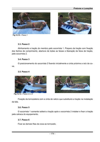 Fraturas e Luxações
3.3. Passo 2
Alinhamento e tração do membro pelo socorrista 1. Preparo da tração com fixação
dos fechos de comprimento, abertura de todas as faixas e liberação da faixa de tração,
pelo socorrista 2.
3.4. Passo 3
O posicionamento do socorrista 2 fixando inicialmente a cinta próxima a raíz da co-
xa.
3.5. Passo 4
Fixação da tornozeleira com a cinta de velcro que substituirá a tração na instalação
da tala.
3.6. Passo 5
O socorrista 1 somente soltará a tração após o socorrista 2 instalar e fixar a tração
pela catraca do equipamento.
3.7. Passo 6
Fixar as demais fitas da coxa ao tornozelo.
- 174 -
Fig 12.13 – Passo 2,3 e 4
Fig 12.12 – Passo 1
 