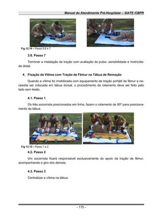 Manual do Atendimento Pré-Hospitalar – SIATE /CBPR
3.8. Passo 7
Terminar a instalação da tração com avaliação do pulso, sensibilidade e motricida-
de distal.
4. Fixação da Vitima com Tração de Fêmur na Tábua de Remoção
Quando a vítima foi imobilizada com equipamento de tração portátil de fêmur e ne-
cessita ser colocada em tábua dorsal, o procedimento de rolamento deve ser feito pelo
lado sem lesão.
4.1. Passo 1
Os três socorrista posicionados em linha, fazem o rolamento de 90º para posiciona-
mento da tábua.
4.2. Passo 2
Um socorrista ficará responsável exclusivamente do apoio da tração de fêmur,
acompanhando o giro dos demais.
4.3. Passo 3
Centralizar a vítima na tábua.
- 175 -
Fig 12.14 – Passo 5,6 e 7.
Fig 12.15 – Passo 1 e 2
 
