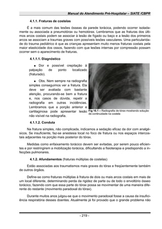 Manual do Atendimento Pré-Hospitalar – SIATE /CBPR
4.1.1. Fraturas de costelas
É a mais comum das lesões ósseas da parede torácica, podendo ocorrer isolada-
mente ou associada a pneumotórax ou hemotórax. Lembramos que as fraturas dos últi-
mos arcos costais podem se associar à lesão de fígado ou baço e a lesão dos primeiros
arcos se associam a traumas graves com possíveis lesões vasculares. Uma particularida-
de do trauma pediátrico é que as crianças apresentam muito menos fraturas costais pela
maior elasticidade dos ossos, fazendo com que lesões internas por compressão possam
ocorrer sem o aparecimento de fraturas.
4.1.1.1. Diagnóstico
● Dor e possível crepitação à
palpação de ponto localizado
(fraturado).
● Obs. Nem sempre na radiografia
simples conseguimos ver a fratura. Ela
deve ser avaliada com bastante
atenção, procurando-se bem a fratura
e, nos casos de dúvida, repetir a
radiografia em outras incidências.
Lembramos que a porção anterior e
cartilaginosa pode apresentar lesão
não visível na radiografia.
4.1.1.2. Conduta
Na fratura simples, não complicada, indicamos a sedação eficaz da dor com analgé-
sicos. Se insuficiente, faz-se anestesia local no foco de fratura ou nos espaços intercos-
tais adjacentes na porção mais posterior do tórax.
Medidas como enfaixamento torácico devem ser evitadas, por serem pouco eficien-
tes e por restringirem a mobilização torácica, dificultando a fisioterapia e predispondo a in-
fecções pulmonares.
4.1.2. Afundamentos (fraturas múltiplas de costelas)
Estão associadas aos traumatismos mais graves do tórax e freqüentemente também
de outros órgãos.
Define-se como fraturas múltiplas à fratura de dois ou mais arcos costais em mais de
um local diferente, determinando perda da rigidez de parte ou de todo o envoltório ósseo
torácico, fazendo com que essa parte do tórax possa se movimentar de uma maneira dife-
rente do restante (movimento paradoxal do tórax).
Durante muitos anos julgou-se que o movimento paradoxal fosse a causa da insufici-
ência respiratória desses doentes. Atualmente já foi provado que o grande problema não
- 219 -
Fig 16.1 – Radiografia de tórax mostrando solução
de continuidade na costela
 