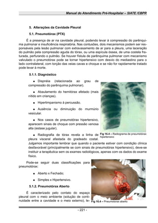 Manual do Atendimento Pré-Hospitalar – SIATE /CBPR
5. Alterações da Cavidade Pleural
5.1. Pneumotórax (PTX)
É a presença de ar na cavidade pleural, podendo levar à compressão do parênqui-
ma pulmonar e insuficiência respiratória. Nas contusões, dois mecanismos podem ser res-
ponsáveis pela lesão pulmonar com extravasamento de ar para a pleura, uma laceração
do pulmão pela compressão aguda do tórax, ou uma espícula óssea, de uma costela fra-
turada, perfurando o pulmão. Se houver fístula de parênquima pulmonar com mecanismo
valvulado o pneumotórax pode se tornar hipertensivo com desvio do mediastino para o
lado contralateral, com torção das veias cavas e choque e se não for rapidamente tratado
pode levar à morte.
5.1.1. Diagnóstico
● Dispnéia (relacionada ao grau de
compressão do parênquima pulmonar).
● Abaulamento do hemitórax afetado (mais
nítido em crianças).
● Hipertimpanismo à percussão.
● Ausência ou diminuição do murmúrio
vesicular.
● Nos casos de pneumotórax hipertensivo,
aparecem sinais de choque com pressão venosa
alta (estase jugular).
● Radiografia de tórax revela a linha de
pleura visceral afastada do gradeado costal.
Julgamos importante lembrar que quando o paciente estiver com condição clínica
desfavorável (principalmente se com sinais de pneumotórax hipertensivo), deve-se
instituir a terapêutica sem os exames radiológicos, apenas com os dados do exame
físico.
Pode-se seguir duas classificações para
pneumotórax:
● Aberto x Fechado;
● Simples x Hipertensivo.
5.1.2. Pneumotórax Aberto
É caracterizado pelo contato do espaço
pleural com o meio ambiente (solução de conti-
nuidade entre a cavidade e o meio externo), le-
- 221 -
Fig 16.4 – Radiograma de pneumotórax
hipertensivo
Fig 16.4 – Pneumotorax aberto
 