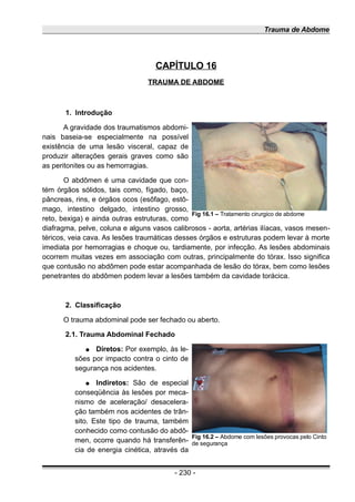 Trauma de Abdome
CAPÍTULO 16
TRAUMA DE ABDOME
1. Introdução
A gravidade dos traumatismos abdomi-
nais baseia-se especialmente na possível
existência de uma lesão visceral, capaz de
produzir alterações gerais graves como são
as peritonites ou as hemorragias.
O abdômen é uma cavidade que con-
tém órgãos sólidos, tais como, fígado, baço,
pâncreas, rins, e órgãos ocos (esôfago, estô-
mago, intestino delgado, intestino grosso,
reto, bexiga) e ainda outras estruturas, como
diafragma, pelve, coluna e alguns vasos calibrosos - aorta, artérias ilíacas, vasos mesen-
téricos, veia cava. As lesões traumáticas desses órgãos e estruturas podem levar à morte
imediata por hemorragias e choque ou, tardiamente, por infecção. As lesões abdominais
ocorrem muitas vezes em associação com outras, principalmente do tórax. Isso significa
que contusão no abdômen pode estar acompanhada de lesão do tórax, bem como lesões
penetrantes do abdômen podem levar a lesões também da cavidade torácica.
2. Classificação
O trauma abdominal pode ser fechado ou aberto.
2.1. Trauma Abdominal Fechado
● Diretos: Por exemplo, às le-
sões por impacto contra o cinto de
segurança nos acidentes.
● Indiretos: São de especial
conseqüência às lesões por meca-
nismo de aceleração/ desacelera-
ção também nos acidentes de trân-
sito. Este tipo de trauma, também
conhecido como contusão do abdô-
men, ocorre quando há transferên-
cia de energia cinética, através da
- 230 -
Fig 16.1 – Tratamento cirurgico de abdome
Fig 16.2 – Abdome com lesões provocas pelo Cinto
de segurança
 
