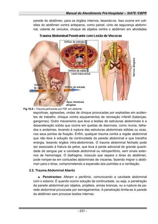 Manual do Atendimento Pré-Hospitalar – SIATE /CBPR
parede do abdômen, para os órgãos internos, lesando-os. Isso ocorre em coli-
sões do abdômen contra anteparos, como painel, cinto de segurança abdomi-
nal, volante de veículos, choque de objetos contra o abdômen em atividades
esportivas, agressões, ondas de choque provocadas por explosões em aciden-
tes de trabalho, choque contra equipamentos de recreação infantil (balanças,
gangorras). Outro mecanismo que leva a lesões de estruturas abdominais é a
desaceleração súbita que ocorre em quedas de desníveis, como muros, telha-
dos e andaimes, levando à ruptura das estruturas abdominais sólidas ou ocas,
nos seus pontos de fixação. Enfim, qualquer trauma contra a região abdominal
que não leve à solução de continuidade da parede abdominal e que transfira
energia, lesando órgãos intra-abdominais. O trauma abdominal fechado pode
ser associado à fratura da pelve, que leva à perda adicional de grande quanti-
dade de sangue par a cavidade abdominal ou retroperitônio, sem sinais exter-
nos de hemorragia. O diafragma, músculo que separa o tórax do abdômen,
pode romper-se em contusões abdominais de vísceras, fazendo migrar o abdô-
men para o tórax, comprometendo a expansão dos pulmões e a ventilação.
2.2. Trauma Abdominal Aberto
● Penetrantes: Afetam o peritônio, comunicando a cavidade abdominal
com o exterior. É quando ocorre solução de continuidade, ou seja, a penetração
da parede abdominal por objetos, projéteis, armas brancas, ou a ruptura da pa-
rede abdominal provocada por esmagamentos. A penetração limita-se à parede
do abdômen sem provocar lesões internas.
- 231 -
Fig 16.4 – Trauma perfurante por FAF em abdome
 