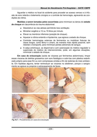 Manual do Atendimento Pré-Hospitalar – SIATE /CBPR
Aguardar o médico no local do acidente para proceder ao acesso venoso e à infu-
são de soro retarda o tratamento cirúrgico e o controle da hemorragia, agravando as con-
dições da vítima.
Medidas a serem tomadas pelos socorristas para minimizar os danos do estado
de choque em decorrência do trauma abdominal:
● Desobstruir as vias aéreas permitindo boa ventilação.
● Ministrar oxigênio a 12 ou 15 litros por minuto.
● Elevar os membros inferiores (posição de choque).
● Aquecer a vítima evitando a hipotermia, que agrava o estado de choque.
● Controlar hemorragias externas de ferimentos ou imobilizar fraturas de
ossos longos, como fêmur e úmero, da maneira mais rápida possível, sem
retardar o transporte, para minimizar perdas adicionais de sangue.
● A calça antichoque, se disponível e com autorização do médico regulador e
supervisão do médico de intervencionista, pode, em algumas situações,
minimizar o estado de choque.
Em caso de evisceração (saída de vísceras por ferimentos abdominais), limpar
essas vísceras de detritos grosseiros com soro fisiológico e cobri-Ias com plástico esterili-
zado próprio para esse fim ou com compressas úmidas a fim de isolá-las do meio ambien-
te. Em hipótese alguma, tentar reintroduzir as vísceras no abdômen, porque o sangra-
mento se agrava ou propicia o extravasamento de fezes.
- 235 -
Fig 16.7 – Procedimentos em casos de evisceração
 
