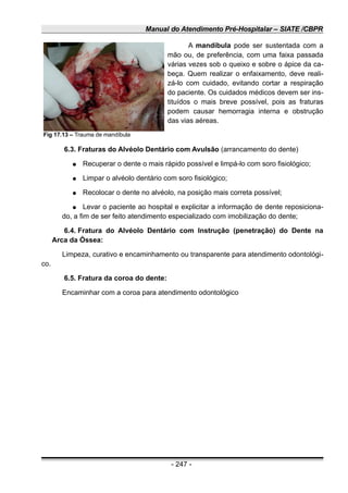 Manual do Atendimento Pré-Hospitalar – SIATE /CBPR
A mandíbula pode ser sustentada com a
mão ou, de preferência, com uma faixa passada
várias vezes sob o queixo e sobre o ápice da ca-
beça. Quem realizar o enfaixamento, deve reali-
zá-lo com cuidado, evitando cortar a respiração
do paciente. Os cuidados médicos devem ser ins-
tituídos o mais breve possível, pois as fraturas
podem causar hemorragia interna e obstrução
das vias aéreas.
6.3. Fraturas do Alvéolo Dentário com Avulsão (arrancamento do dente)
● Recuperar o dente o mais rápido possível e limpá-lo com soro fisiológico;
● Limpar o alvéolo dentário com soro fisiológico;
● Recolocar o dente no alvéolo, na posição mais correta possível;
● Levar o paciente ao hospital e explicitar a informação de dente reposiciona-
do, a fim de ser feito atendimento especializado com imobilização do dente;
6.4. Fratura do Alvéolo Dentário com Instrução (penetração) do Dente na
Arca da Óssea:
Limpeza, curativo e encaminhamento ou transparente para atendimento odontológi-
co.
6.5. Fratura da coroa do dente:
Encaminhar com a coroa para atendimento odontológico
- 247 -
Fig 17.13 – Trauma de mandíbula
 