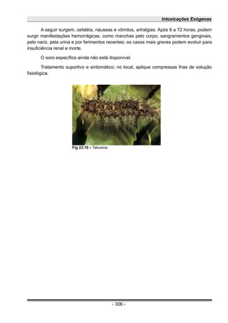 Intoxicações Exógenas
A seguir surgem, cefaléia, náuseas e vômitos, artralgias. Após 8 a 72 horas, podem
surgir manifestações hemorrágicas, como manchas pelo corpo, sangramentos gengivais,
pelo nariz, pela urina e por ferimentos recentes; os casos mais graves podem evoluir para
insuficiência renal e morte.
O soro específico ainda não está disponível.
Tratamento suportivo e sintomático; no local, aplique compressas frias de solução
fisiológica.
- 306 -
Fig 23.10 – Taturana.
 