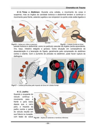 Cinemática do Trauma
4.1.2. Tórax e Abdômen: Durante uma colisão, o movimento do corpo é
suspenso, mas os órgãos da cavidade torácica e abdominal tendem a continuar o
movimento para frente, estando sujeitos a se romperem no ponto onde estão ligados à
parede torácica e abdominal, como no pedículo vascular de órgãos (aorta ascendente,
rins, baço, intestino delgado e grosso). Outra situação em conseqüência da
desaceleração é a laceração do fígado, geralmente pela compressão do abdômen
contra o volante. Com o aumento de pressão no abdômen, pode haver ruptura do
diafragma.
4.1.3. Joelho:
Quando o ocupante do
veículo continua o
movimento para a
frente e para baixo
depois que o carro
para, o impacto do
joelho contra o painel
do veículo resulta em
sua fratura ou luxação,
com lesão de vasos
- 64 -
Fig 4.7 – Lesões produzidas pelo impacto de tórax em colisão frontal
Fig 4.8 – Ações em abdome e membros inferiores
Fig 4.5 – Ações em crânio e pescoço Fig 4.6 – Colisão frontal em tórax
 