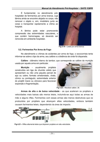 Manual do Atendimento Pré-Hospitalar – SIATE /CBPR
É fundamental, no atendimento pré-
hospitalar de ferimentos por arma branca, cuja
lâmina ainda se encontre alojada no corpo, não
remover o objeto e, sim, imobiliário junto ao
corpo e transportar rapidamente a vítima ao
hospital.
A lâmina pode estar promovendo
compressão das extremidades vasculares, o
que contém hemorragias, só devendo ser
removida em ambiente hospitalar.
Fig 4.19 – Lesão por arma branca.
5.2. Ferimentos Por Arma de Fogo
No atendimento a vítimas de acidentes por arma de fogo, o sococorrista tenta
informar-se sobre o tipo da arma, seu calibre e a distância de onde foi disparada.
Calibre - diâmetro interno do tambor, que corresponde ao calibre da munição
usada por aquela arma em particular.
Munição - usualmente projéteis
construídos em liga de chumbo sólido que
apresentam ou não uma jaqueta parcial de
aço ou cobre; formato arredondado, chato,
cônico ou pontiagudo; extremidade anterior
do projétil macio ou côncavo para favorecer
expansão e fragmentação.
Fig 4.20 – Revolver calibre .38.
Armas de alta e de baixa velocidade - as que aceleram os projéteis a
velocidades mais baixas são menos letais, incluindo-se aqui todas as armas de
mão e alguns rifles. Ferimentos com essas armas são menos destrutivos que os
produzidos por projéteis que alcançam altas velocidades, embora também
causem ferimentos letais, dependendo da área de impacto.
Fig 4.21 – Rifles altamente letais que disparam projéteis em alta velocidade.
- 71 -
 