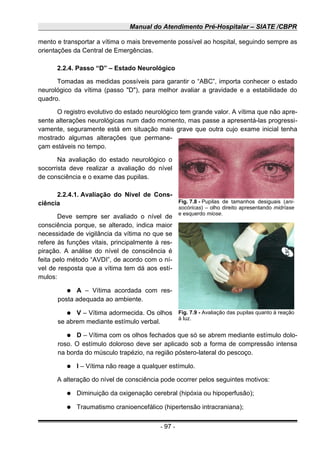 Manual do Atendimento Pré-Hospitalar – SIATE /CBPR
mento e transportar a vítima o mais brevemente possível ao hospital, seguindo sempre as
orientações da Central de Emergências.
2.2.4. Passo “D” – Estado Neurológico
Tomadas as medidas possíveis para garantir o “ABC”, importa conhecer o estado
neurológico da vítima (passo "D"), para melhor avaliar a gravidade e a estabilidade do
quadro.
O registro evolutivo do estado neurológico tem grande valor. A vítima que não apre-
sente alterações neurológicas num dado momento, mas passe a apresentá-las progressi-
vamente, seguramente está em situação mais grave que outra cujo exame inicial tenha
mostrado algumas alterações que permane-
çam estáveis no tempo.
Na avaliação do estado neurológico o
socorrista deve realizar a avaliação do nível
de consciência e o exame das pupilas.
2.2.4.1. Avaliação do Nível de Cons-
ciência
Deve sempre ser avaliado o nível de
consciência porque, se alterado, indica maior
necessidade de vigilância da vítima no que se
refere às funções vitais, principalmente à res-
piração. A análise do nível de consciência é
feita pelo método “AVDI”, de acordo com o ní-
vel de resposta que a vítima tem dá aos estí-
mulos:
● A – Vítima acordada com res-
posta adequada ao ambiente.
● V – Vítima adormecida. Os olhos
se abrem mediante estímulo verbal.
● D – Vítima com os olhos fechados que só se abrem mediante estímulo dolo-
roso. O estímulo doloroso deve ser aplicado sob a forma de compressão intensa
na borda do músculo trapézio, na região póstero-lateral do pescoço.
● I – Vítima não reage a qualquer estímulo.
A alteração do nível de consciência pode ocorrer pelos seguintes motivos:
● Diminuição da oxigenação cerebral (hipóxia ou hipoperfusão);
● Traumatismo cranioencefálico (hipertensão intracraniana);
- 97 -
Fig. 7.8 - Pupilas de tamanhos desiguais (ani-
socóricas) – olho direito apresentando midríase
e esquerdo miose.
Fig. 7.9 - Avaliação das pupilas quanto à reação
à luz.
 