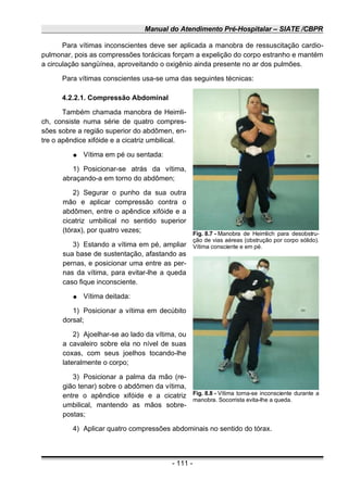 Manual do Atendimento Pré-Hospitalar – SIATE /CBPR
Para vítimas inconscientes deve ser aplicada a manobra de ressuscitação cardio-
pulmonar, pois as compressões torácicas forçam a expelição do corpo estranho e mantém
a circulação sangüínea, aproveitando o oxigênio ainda presente no ar dos pulmões.
Para vítimas conscientes usa-se uma das seguintes técnicas:
4.2.2.1. Compressão Abdominal
Também chamada manobra de Heimli-
ch, consiste numa série de quatro compres-
sões sobre a região superior do abdômen, en-
tre o apêndice xifóide e a cicatriz umbilical.
● Vítima em pé ou sentada:
1) Posicionar-se atrás da vítima,
abraçando-a em torno do abdômen;
2) Segurar o punho da sua outra
mão e aplicar compressão contra o
abdômen, entre o apêndice xifóide e a
cicatriz umbilical no sentido superior
(tórax), por quatro vezes;
3) Estando a vítima em pé, ampliar
sua base de sustentação, afastando as
pernas, e posicionar uma entre as per-
nas da vítima, para evitar-lhe a queda
caso fique inconsciente.
● Vítima deitada:
1) Posicionar a vítima em decúbito
dorsal;
2) Ajoelhar-se ao lado da vítima, ou
a cavaleiro sobre ela no nível de suas
coxas, com seus joelhos tocando-lhe
lateralmente o corpo;
3) Posicionar a palma da mão (re-
gião tenar) sobre o abdômen da vítima,
entre o apêndice xifóide e a cicatriz
umbilical, mantendo as mãos sobre-
postas;
4) Aplicar quatro compressões abdominais no sentido do tórax.
- 111 -
Fig. 8.7 - Manobra de Heimlich para desobstru-
ção de vias aéreas (obstrução por corpo sólido).
Vítima consciente e em pé.
Fig. 8.8 - Vítima torna-se inconsciente durante a
manobra. Socorrista evita-lhe a queda.
 